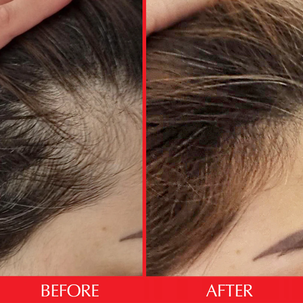 سرم ضد ریزش و تقویت رشد موی هیرتامین Hairtamin Scalp Serum حجم 60 میلی لیتر