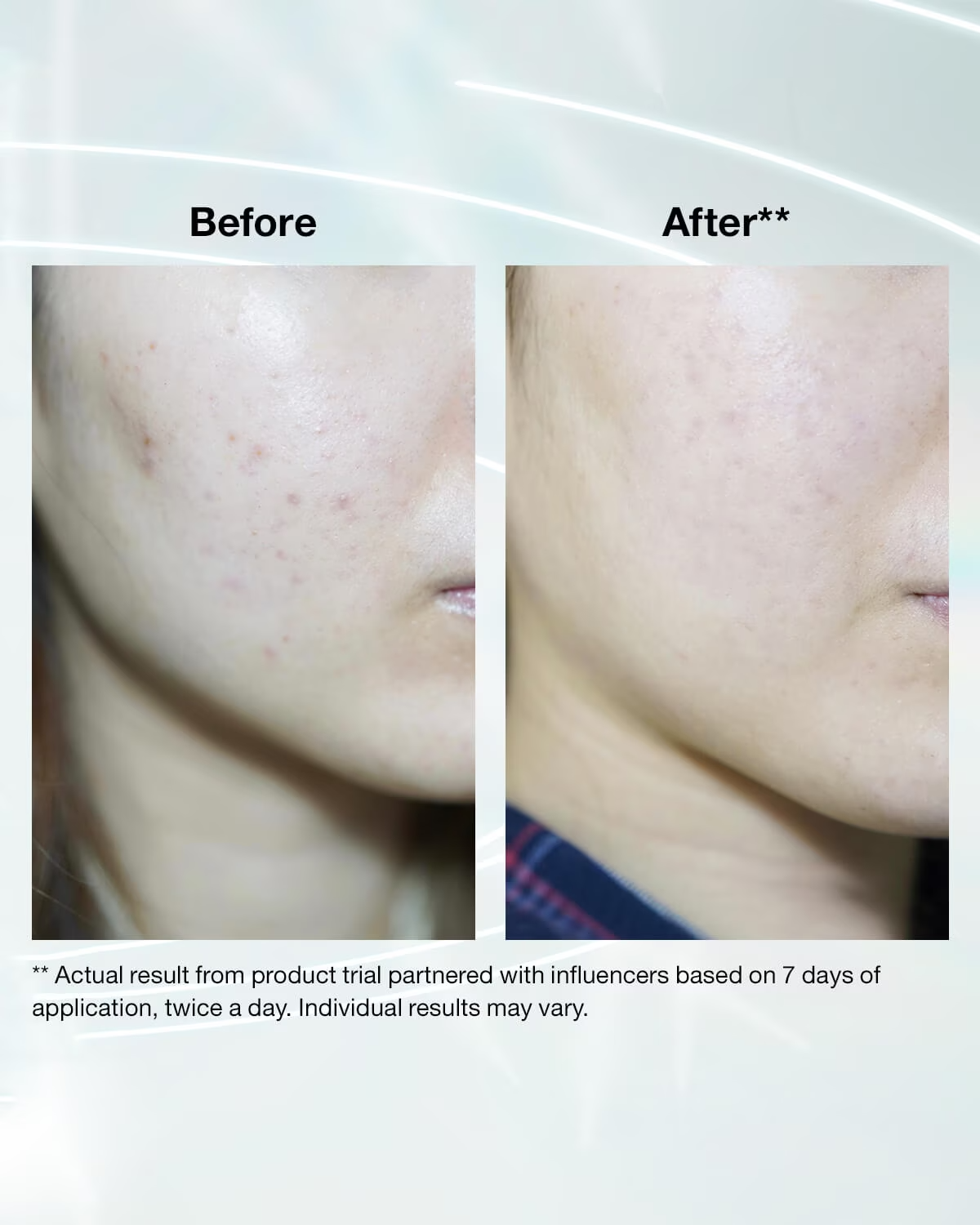 سرم ضد لک کلینیک even better clinical حجم 100 میلی لیتر