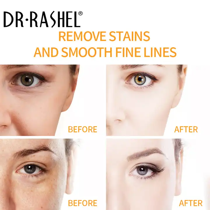 ماسک خاک رس استیکی ویتامین سی و زردچوبه دکتر راشل حجم 42 گرم