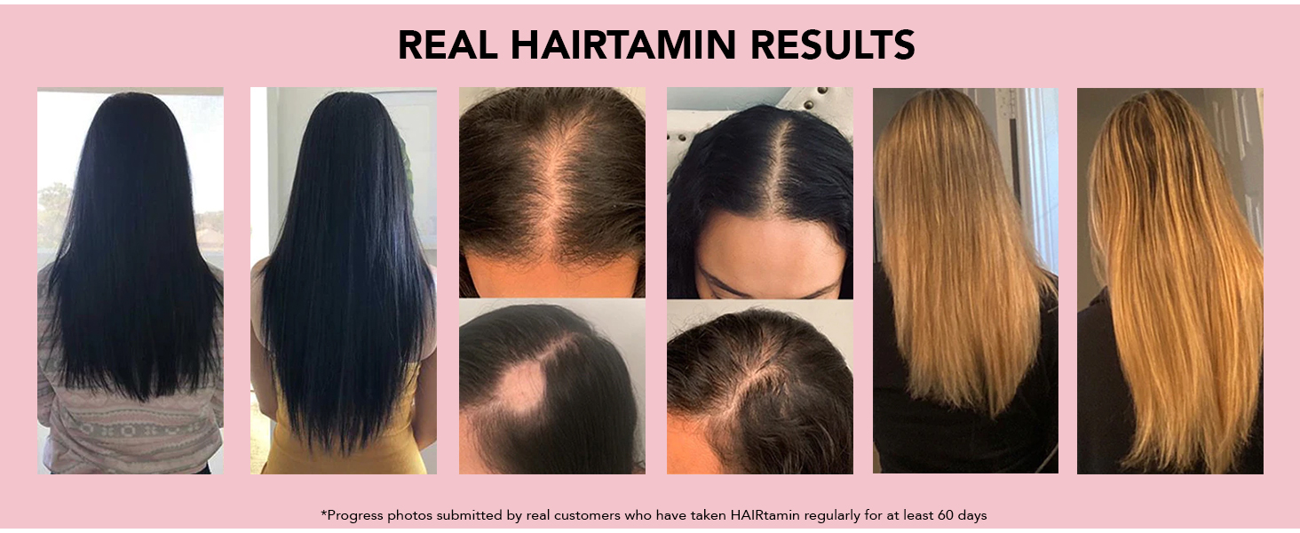 شامپو ضد ریزش و تقویت رشد موی بیوتین هیرتامین Hairtamin Biotin حجم 207 میلی لیتر
