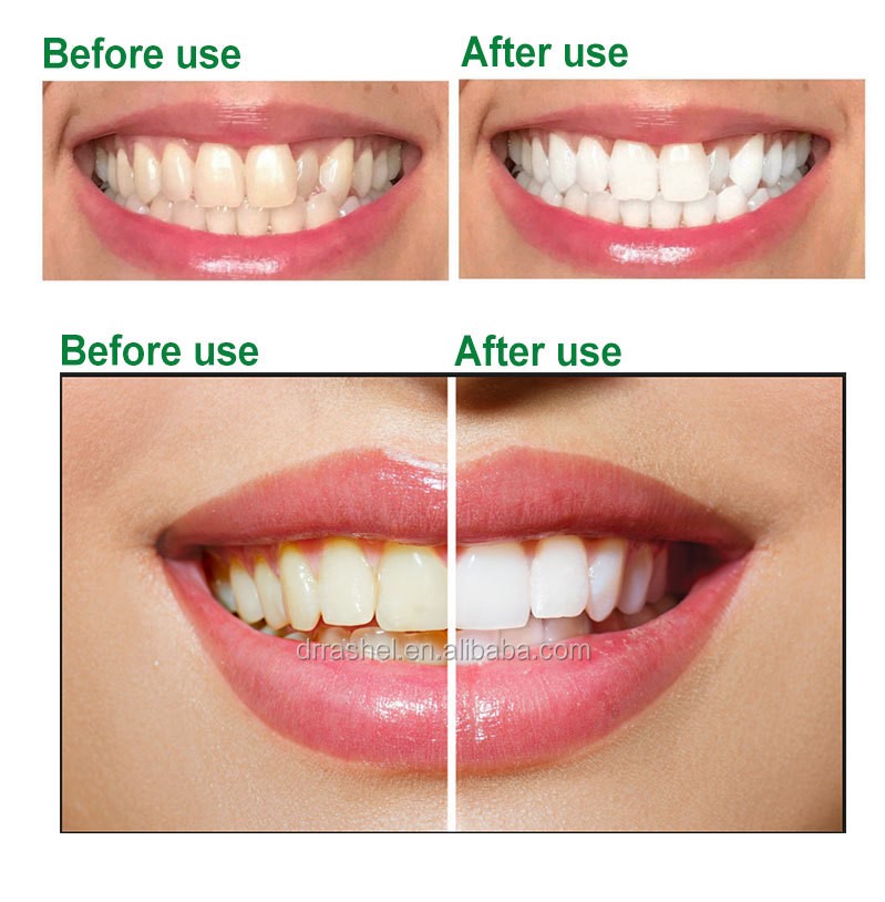 خمیردندان آلوئه ورا دکتر راشل