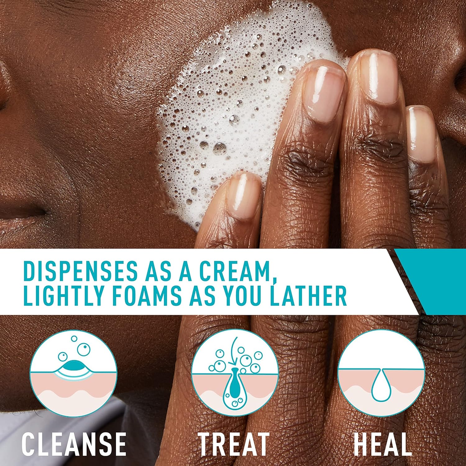 فوم شست‌ و شو ضد جوش سراوی CeraVe حجم 150 میل