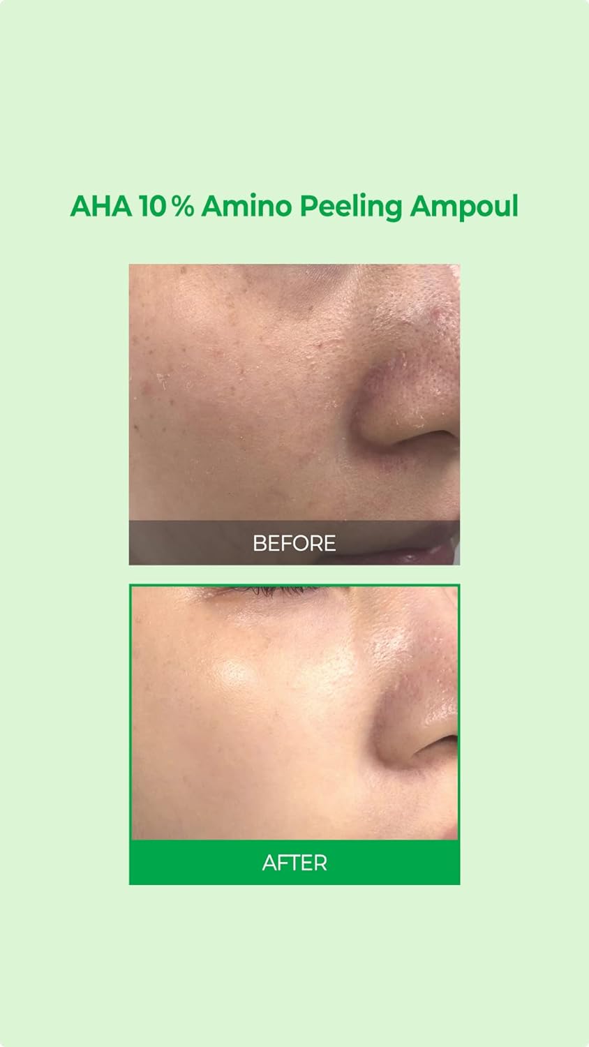 سرم آمپولی لایه بردار و پاکسازی پوست حاوی AHA سام بای می