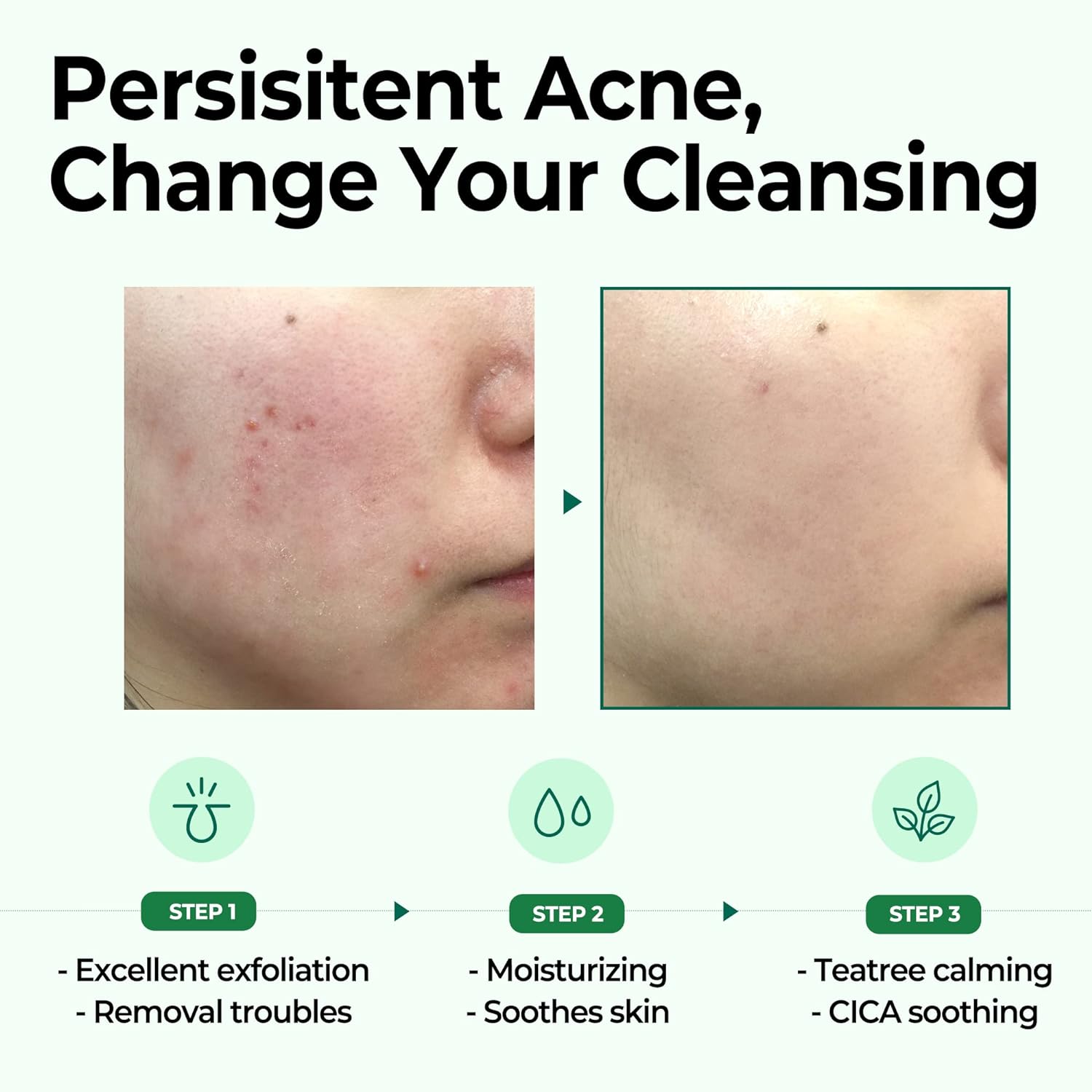 پن شستشو پوست چرب معجره ۳۰ روزه سام بای می