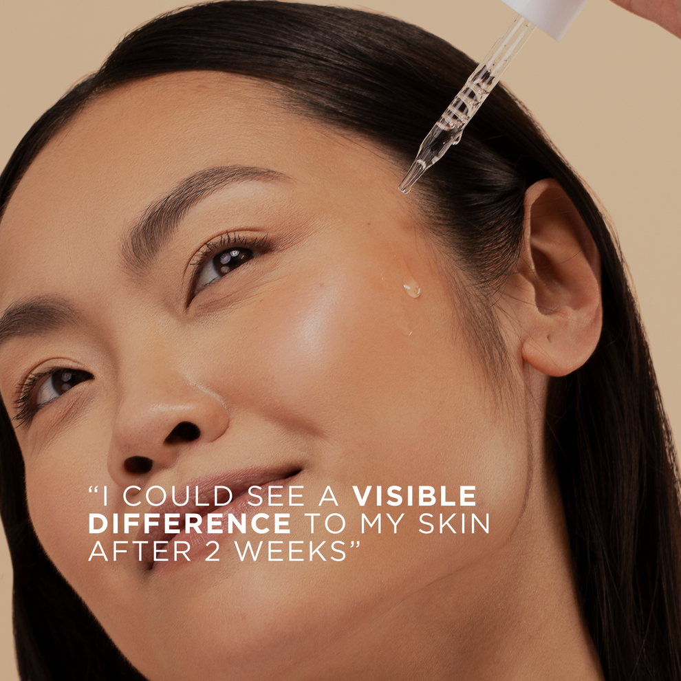 سرم روشن کننده نیاسینامید فیداوت