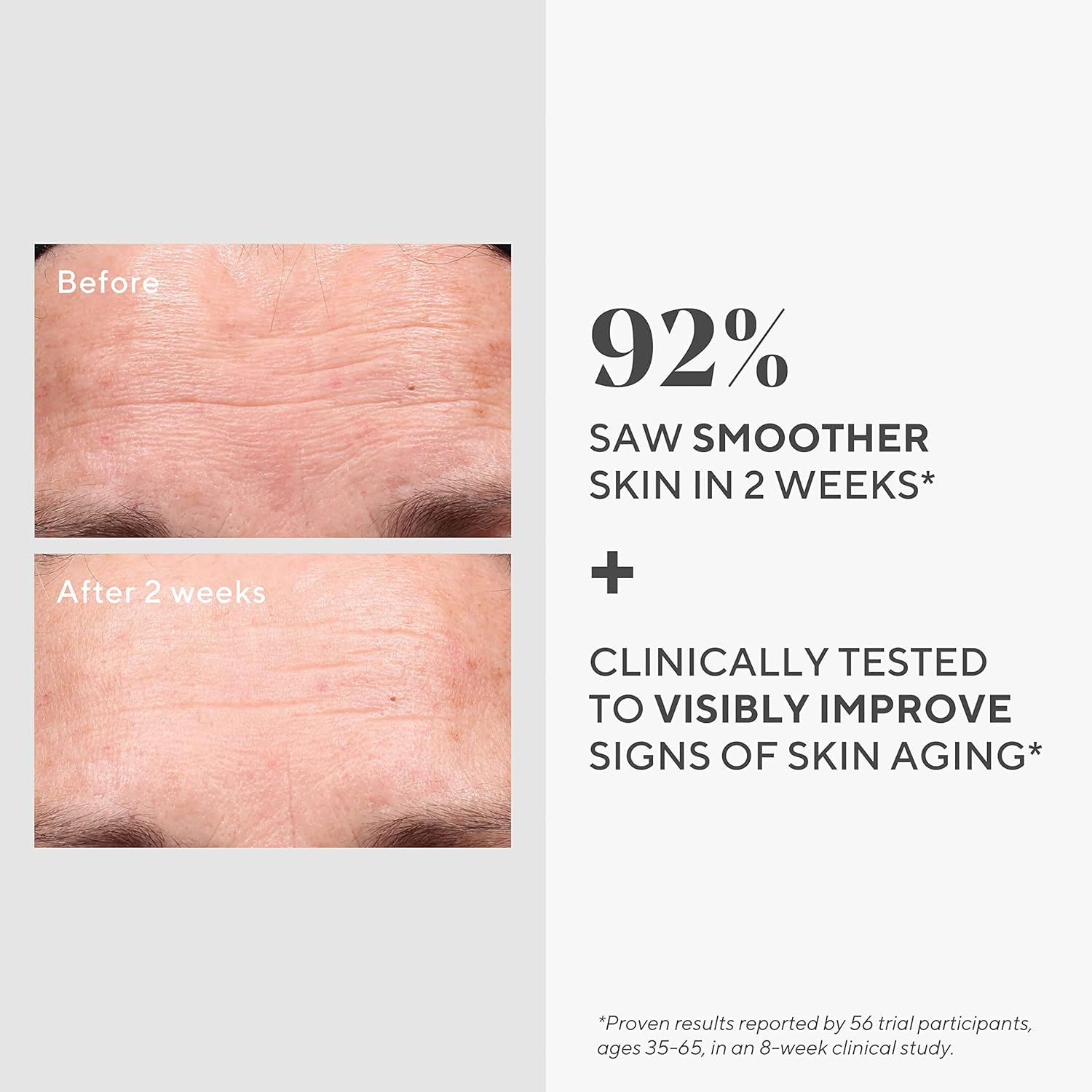 Murad Retinol Youth Renewal Serum